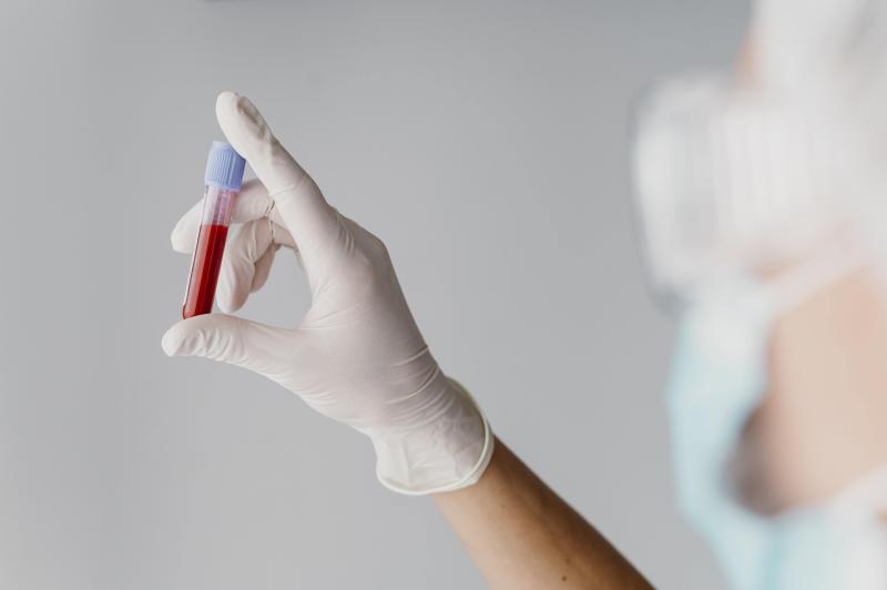 Компания “Б-Армс” разработала установку для получения сублимированной плазмы крови