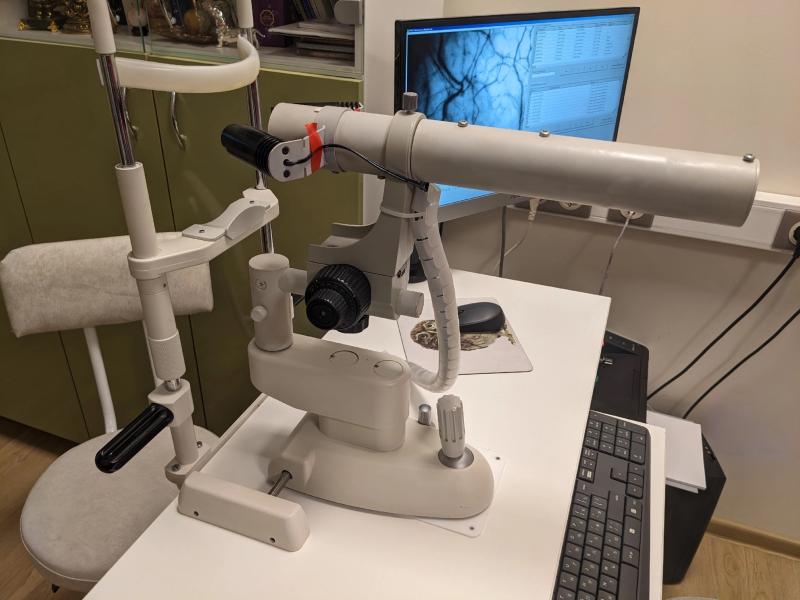 Методика проведения биомикроскопии бульбарной конъюнктивы с использованием капилляроскопа офтальмологического «ОКО»
